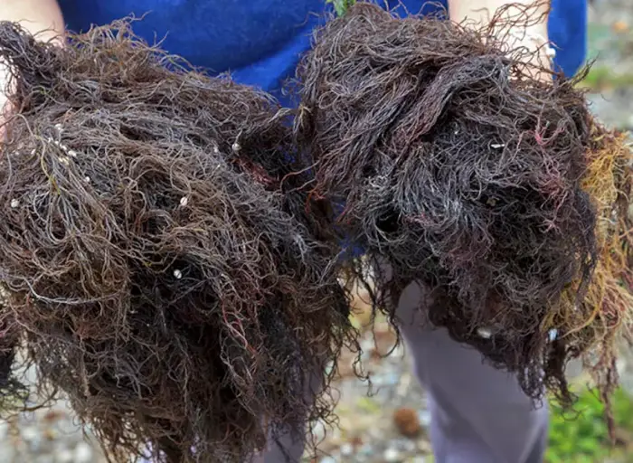 Cáncer de próstata